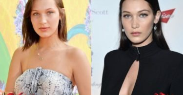 Bella Hadid Before / Bella Hadid's Before & After Surgery Evolution