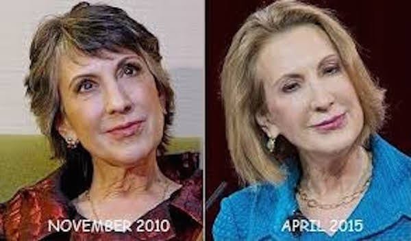 free carly fiorina plastic surgery