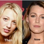 Discover The Truth Behind All Blake Lively Plastic Surgeries!